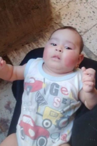 الطفلة مكة ضحية ضرب الاب