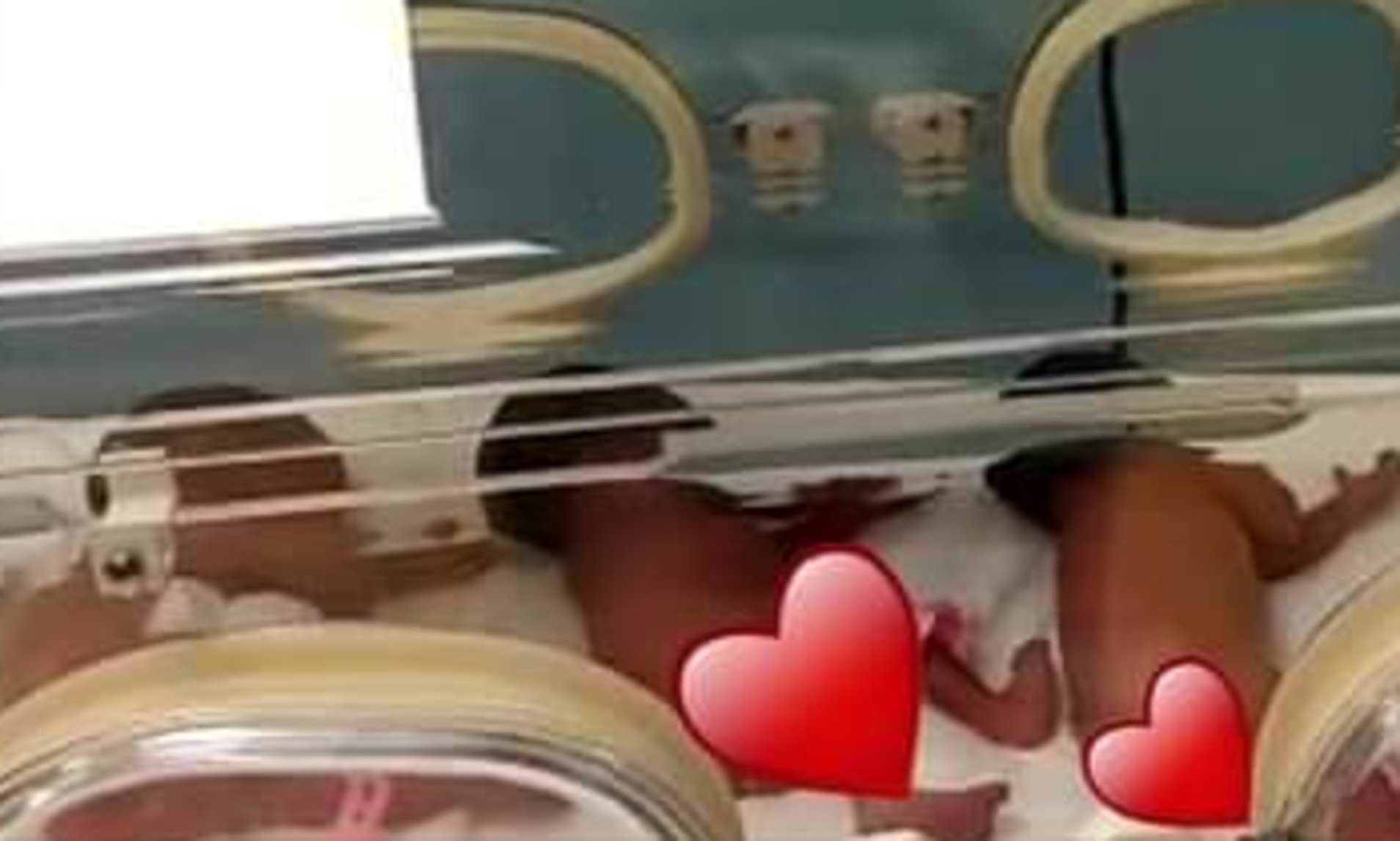 الأطفال التسعة بعد الولادة