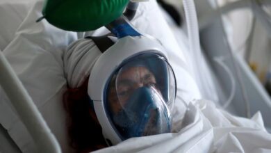 نقص الاكسجين