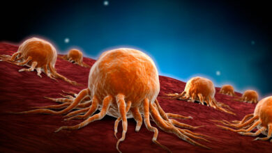 أورام سرطانية